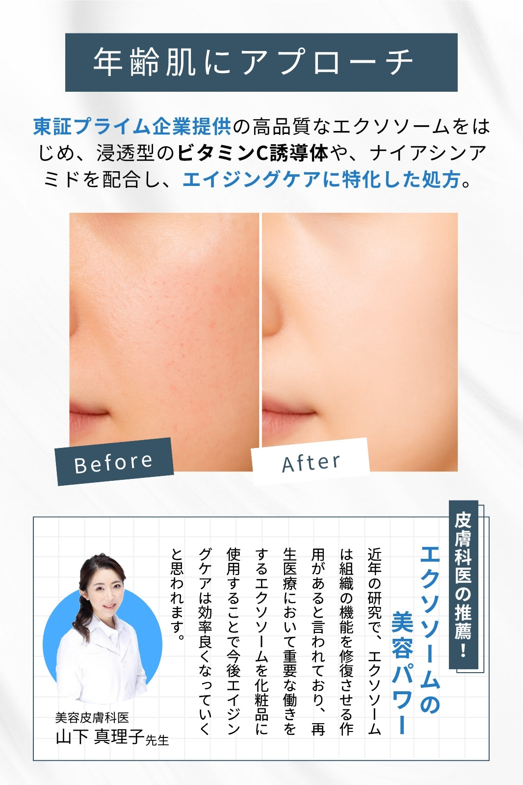 エクソプラス 美容液 | 皮膚科学の力で、肌に実感を。 – EXO PLUS++